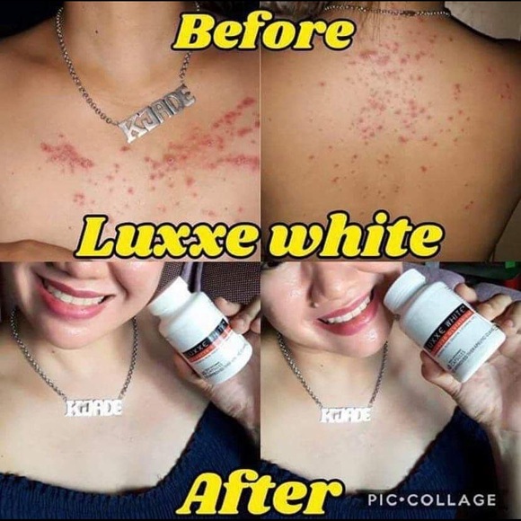 Frontrow Luxxe - Picture 8 of 10